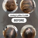 اسکراب اسکالپ تخصصی رستا
