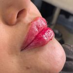 کلینیک زیبایی و لیزر و لاغری ایران درما