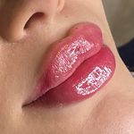 کلینیک زیبایی و لیزر و لاغری ایران درما