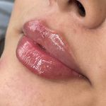 کلینیک زیبایی و لیزر و لاغری ایران درما