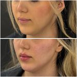 مطب زیبایی لیانارخ