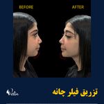 کلینیک زیبایی و جوانسازی پوست و مو الین