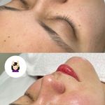 کلینیک پوست و زیبایی ژیلاوَش