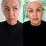 کلینیک زیبایی پارسیان آلفا