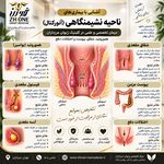 کلینیک تخصصی درمان هموروئید (بواسیر)