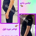 مرکز لاغری موضعی و ایکس بادی فیت اسمارت