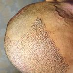 کاشت مو پارساباد