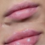 مرکز پوست و مو و لیزر دکتر مهتاب رضوی