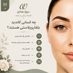 مرکز بلفاروپلاستی فوق تخصصی رز سفید