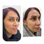 کلینیک تخصصی ژل و بوتاکس مرضیه آقابابایی