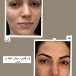 آرایشگاه زنانه إلماه