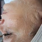 فیشال، پاکسازی و کربوکسی صبا جعفری