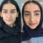 کلینیک لیزر  کندلاوزیبایی پوست ومو آیشیل
