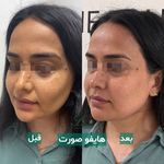 کلینیک زیبایی فرتاک