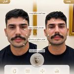 کلینیک پوست مو زیبایی  آیسان امیدی(وتنم)