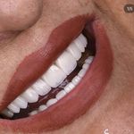 دندانپزشکی الی دنت ‌دیجیتال و اقساطی