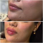 مطب زیبایی لیانارخ