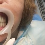 مطب ایمپلنت دکتر نیما شفیعی