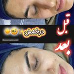 فیشال تخصصی  سعیده صدیقی