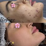 پاکسازی پوست و مو مهسام