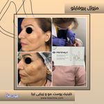 مطب پوست مو زیبایی فردوس شرق