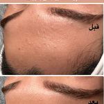 کلینیک پوست،مو و لیزر هانا