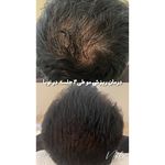 کلینیک زیبایی و لیزر مو زائد نوبا