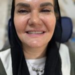 لابراتوار دندانسازی شید