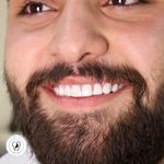 کلینیک دندانپزشکی برکه(قرارداد به بیمه)