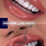کنزودنت