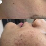 فیشال و خدمات پاکسازی پوست  فاطمه انامی