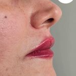 مرکز لیزر و فیلر وجوانسازی وزیبایی شاینا