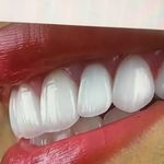 دندانپزشکی هرمس