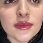 کلینیک زیبایی روناش،دکتر نغمه سروش