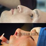 جراحی بینی دکتر اسدالله پور