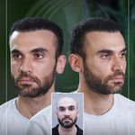 کلینیک پوست مو و زیبایی نوین ایرانا