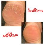 ناخنکار و پدیکوریست