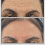 کلینیک ژل بوتاکس لیزر فیل بیوتی