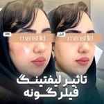 کلینیک زیبایی مانشید
