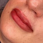 میکروبلیدینگ پریسا پارسا