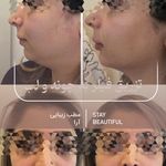 مطب زیبایی آرا