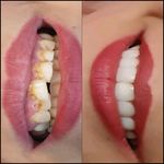 دندانپزشکی دکتر شیرزاد ویسی