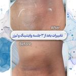 کلینیک پوست مو لیزر و لاغری عصر زیبایی