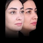 دکتر بهروز جلالی (جراحی بینی لیفت صورت)