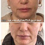 کلینیک زیبایی و لیزر مو زائد نوبا