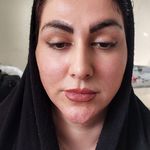 کلینیک زیبایی بهسا