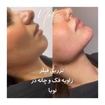 کلینیک زیبایی و لیزر مو زائد نوبا