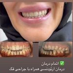 متخصص ارتودنسی دکتر ابریشم چی کرج