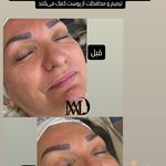 خدمات پوستی میراندا آواک