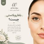 مرکز بلفاروپلاستی فوق تخصصی رز سفید